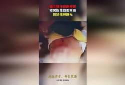 爆料缅北医生视频播放大全,视频播放大全深度解析
